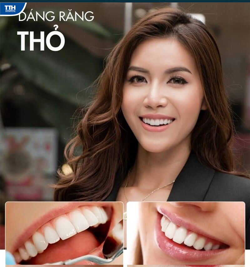 Top 3 dáng răng sứ đẹp được ưa chuộng nhất hiện nay - Bệnh viện đa ...