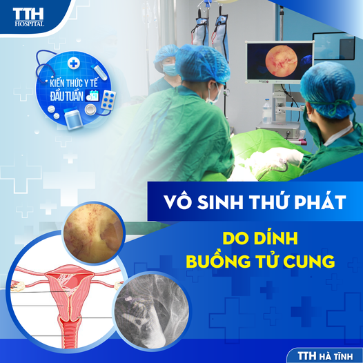 Vô Sinh Chữa Được Không? Tìm Hiểu Về Giải Pháp Hiện Đại