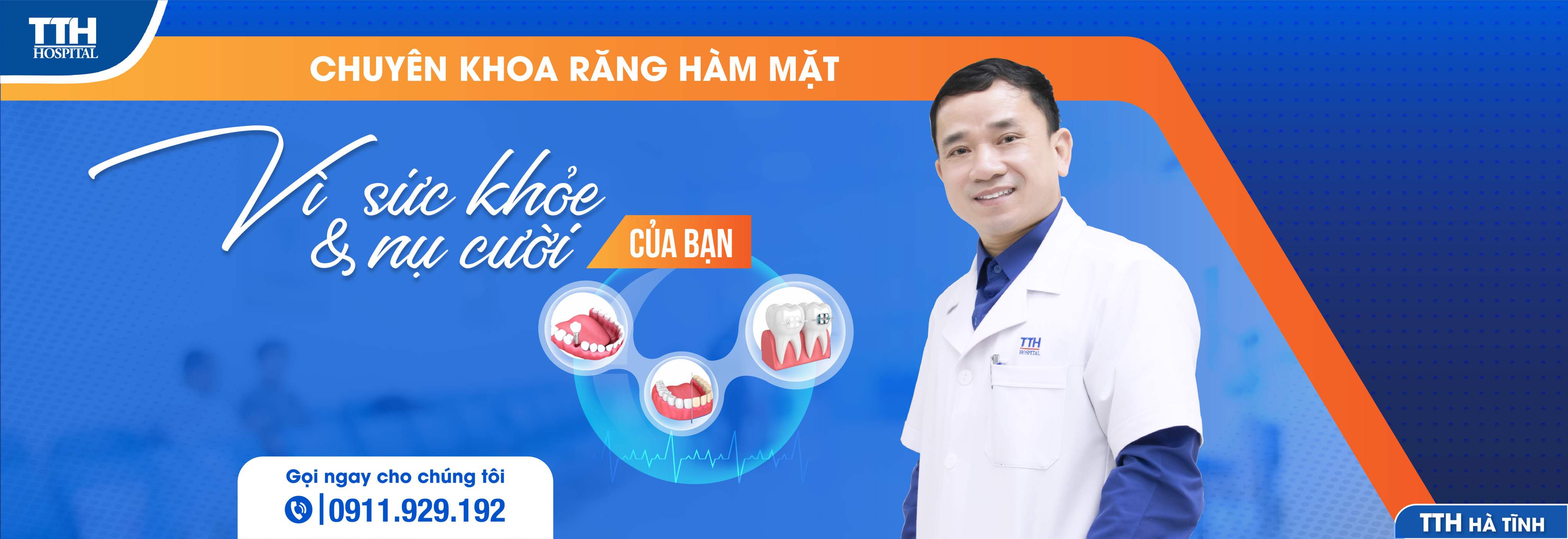 CẮM TRỤ IMPLANT VÀ NHỮNG ĐIỀU CẦN BIẾT