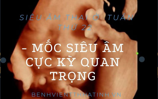 Siêu âm thai ở  tuần thứ 22