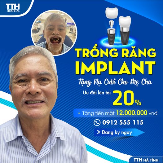 TRỒNG RĂNG IMPLANT – TẶNG NỤ CƯỜI CHO MẸ CHA