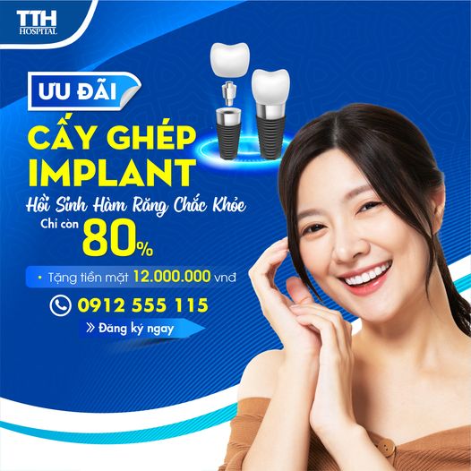 ƯU ĐÃI CẤY GHÉP IMPLANT – HỒI SINH HÀM RĂNG CHẮC KHỎE