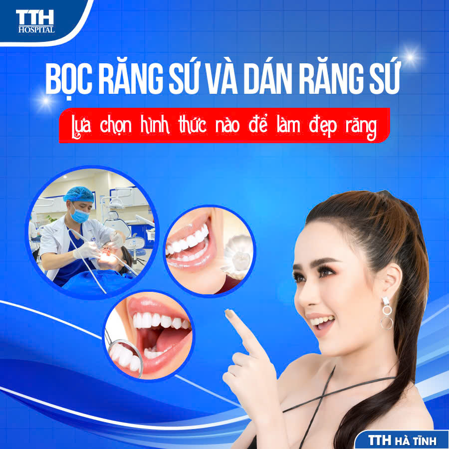 NÊN DÁN RĂNG SỨ HAY BỌC RĂNG SỨ ĐỂ “THAY ÁO MỚI” CHO RĂNG?