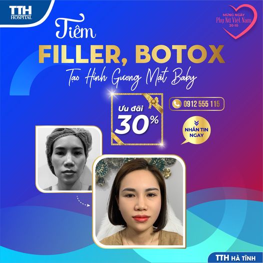 TIÊM FILLER, BOTOX - TẠO HÌNH GƯƠNG MẶT BABY