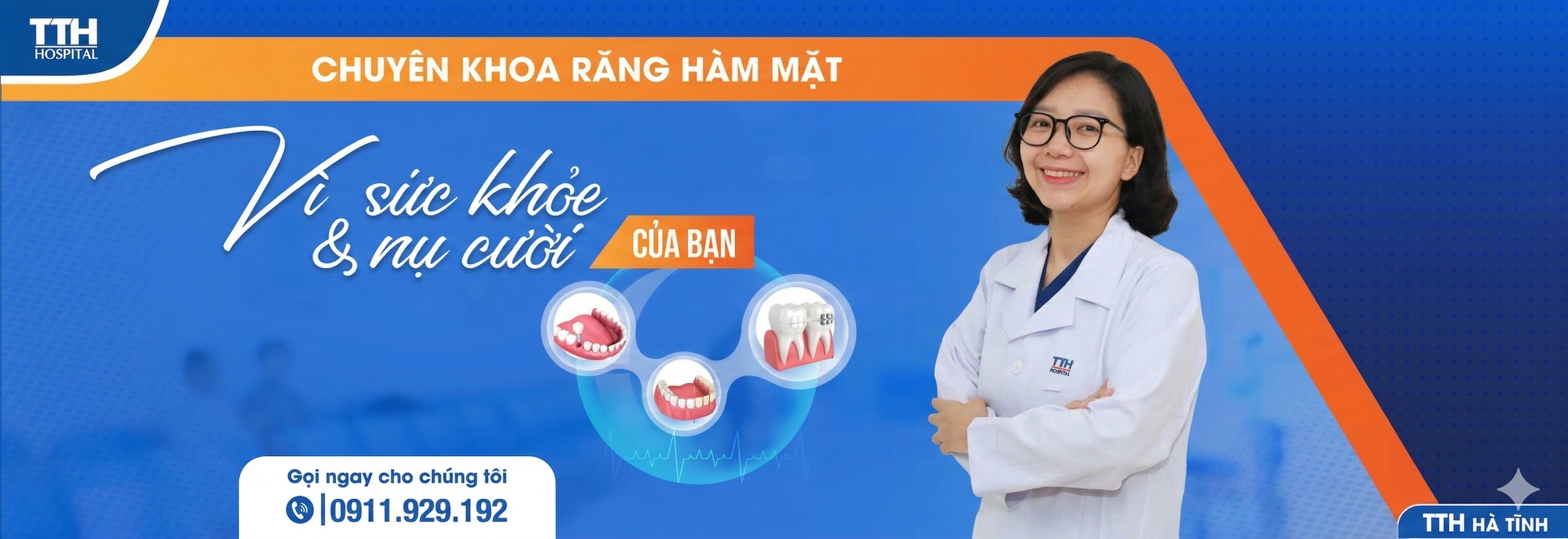 Niềng răng mắc cài kim loại tự buộc
