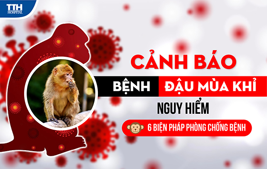 Bệnh đậu mùa khỉ