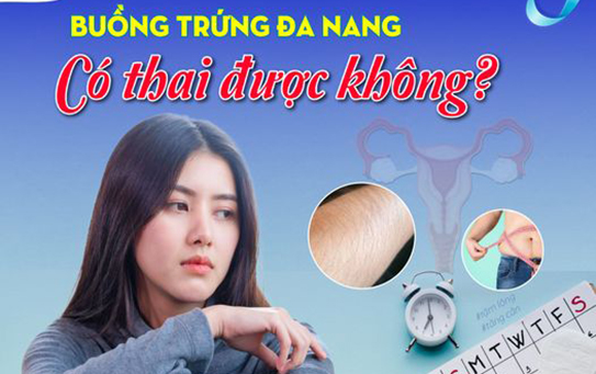 BUỒNG TRỨNG ĐA NANG CÓ THAI ĐƯỢC KHÔNG?