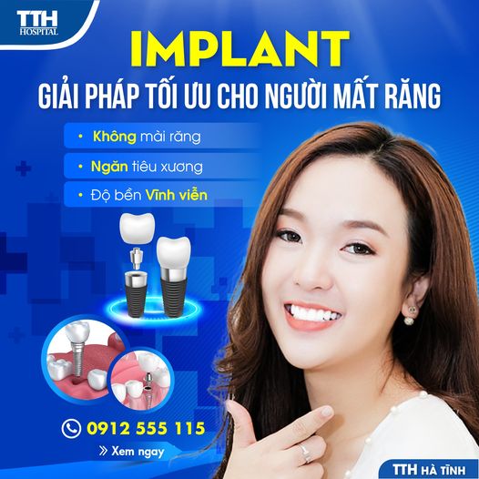 IMPLANT - GIẢI PHÁP TỐI ƯU CHO NGƯỜI MẤT RĂNG