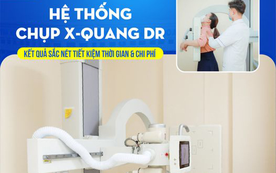 Hệ thống chụp x-quang dr"kết quả sắc nét