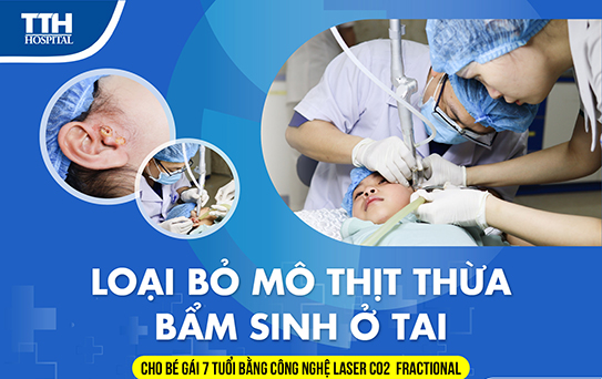 loại bỏ mô thịt thừa bẩm sinh ở tai cho bé gái