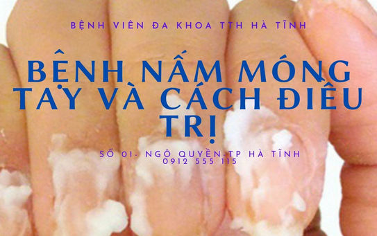 BỆNH NẤM MÓNG TAY VÀ CÁCH ĐIỀU TRỊ