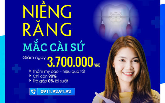 Niềng răng mắc cài sứ thẫm mỹ cao-hiệu quả tốt