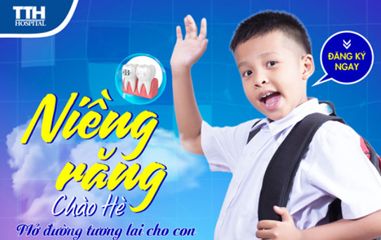 Niềng răng chào hè