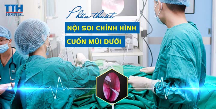 PHẪU THUẬT NỘI SOI CHỈNH HÌNH CUỐN MŨI DƯỚI AN TOÀN TẠI TTH HÀ TĨNH