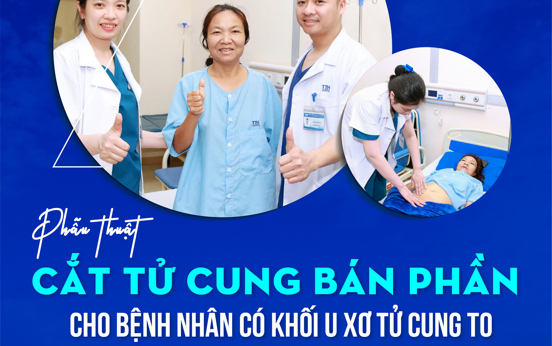 PHẪU THUẬT CẮT TỬ CUNG BÁN PHẦN CHO BỆNH NHÂN CÓ KHỐI U XƠ TỬ CUNG TO