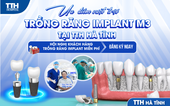 NHỮNG ƯU ĐIỂM VƯỢT TRỘI CỦA TRỒNG RĂNG IMPLANT M3 TẠI TTH HÀ TĨNH