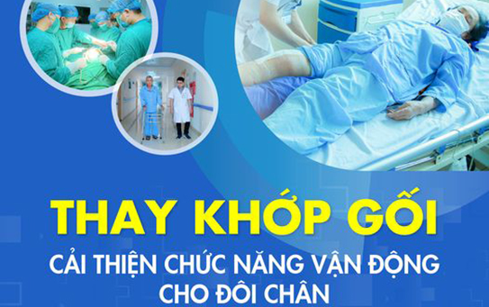 Thay khớp gối cải thiện chức năng vận động cho đôi chân