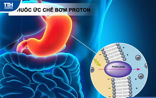 Sử dụng hợp lý thuốc ức chế bơm proton