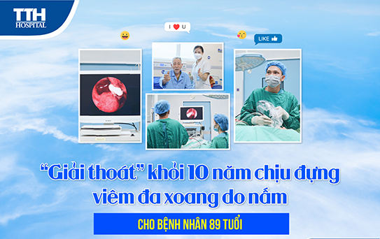 Viêm đa xoang do nấm