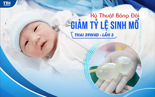 khởi phát chuyển dạ bằng bóng đôi giúp hạn chế sinh mổ