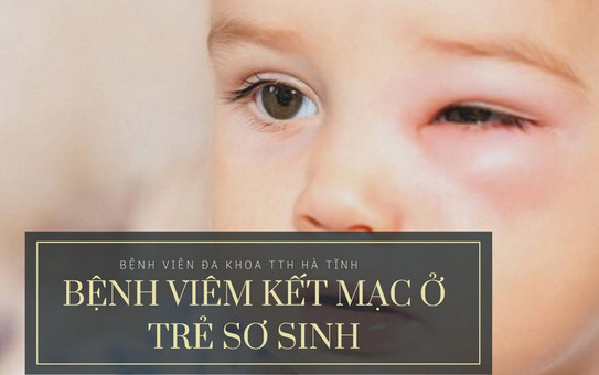 Bệnh viêm kết mạc ở trẻ sơ sinh