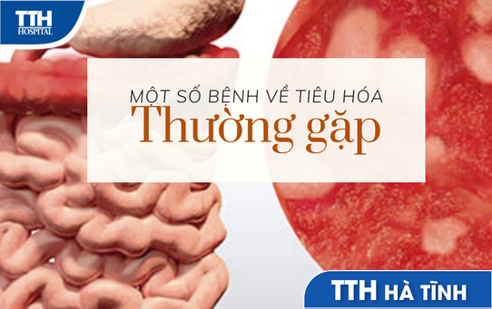 Bệnh tiêu hóa thường gặp và những điều cần biết