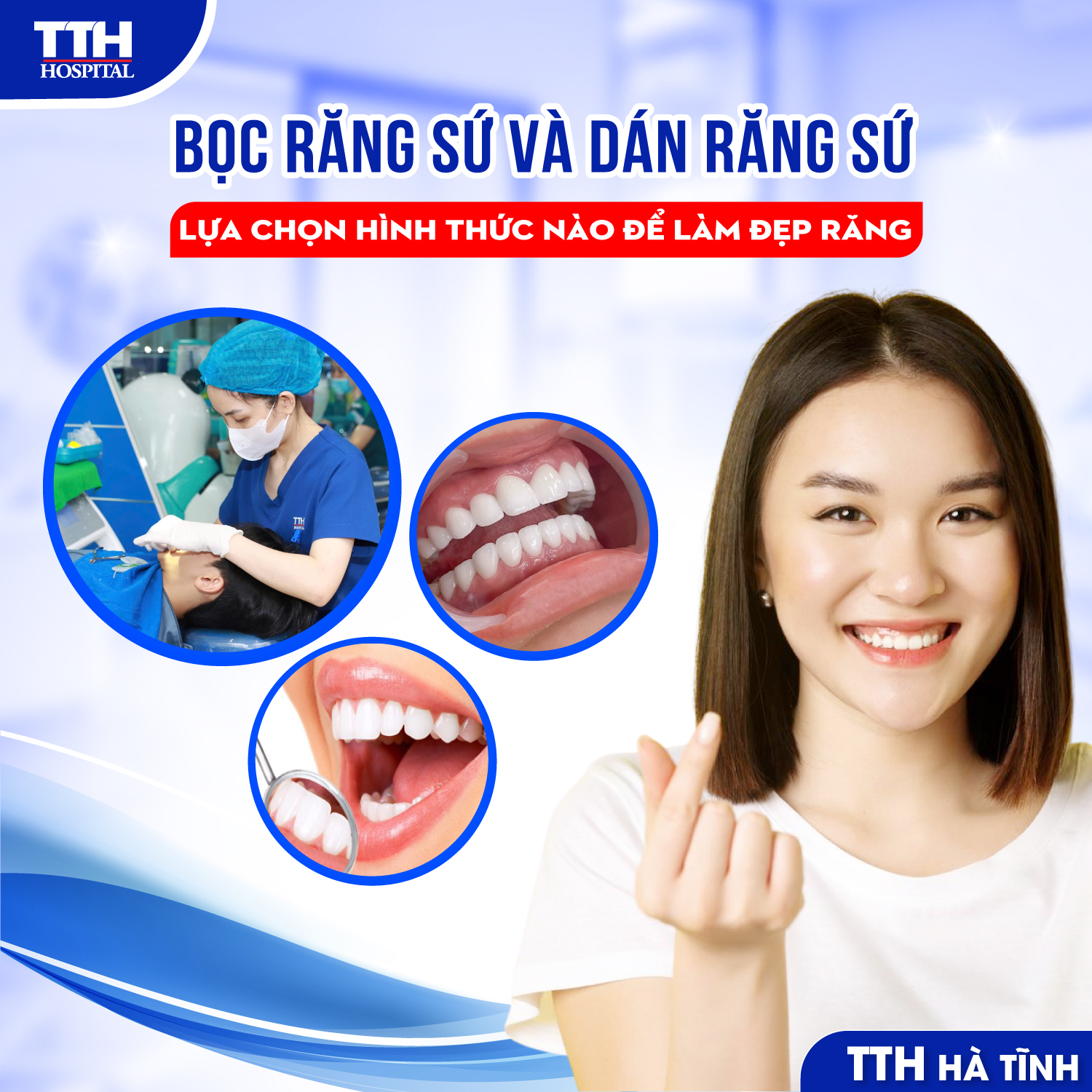 LÀM MỚI NỤ CƯỜI – CHỌN ĐÚNG GIẢI PHÁP: VENEER HAY BỌC RĂNG SỨ?