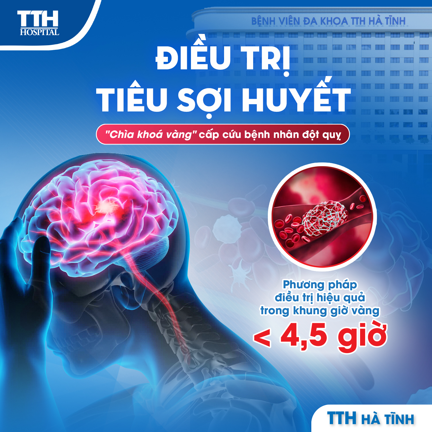 TIÊU SỢI HUYẾT TRONG ĐỘT QUỴ NÃO – CỨU SỐNG NGƯỜI BỆNH TRONG GIỜ VÀNG