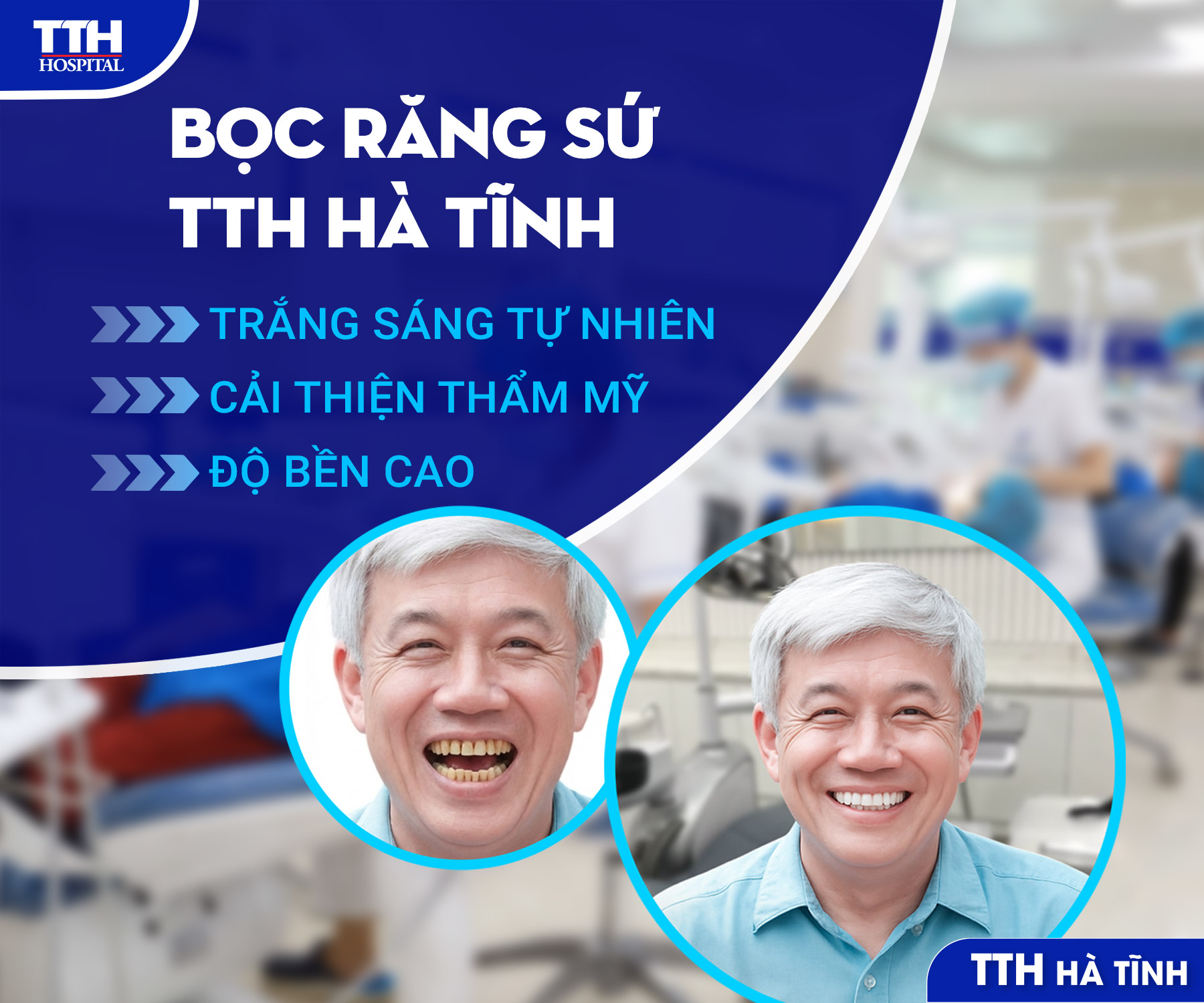 BỌC RĂNG SỨ TẠI TTH HÀ TĨNH - TRẮNG SÁNG TỰ NHIÊN, CƯỜI RẠNG RỠ