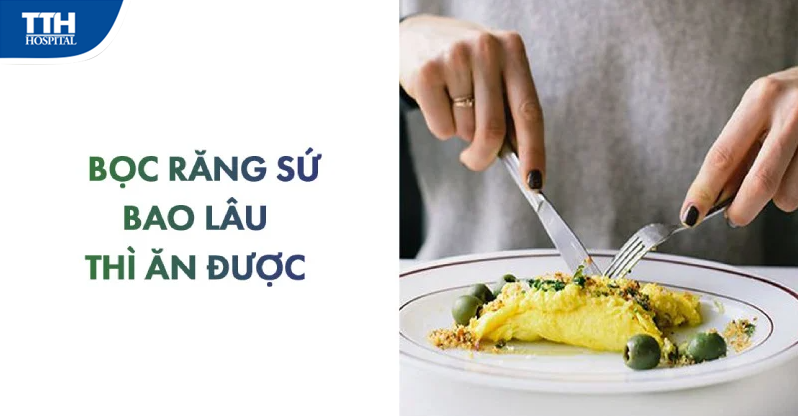 Bọc răng sứ sau bao lâu thì ăn được?