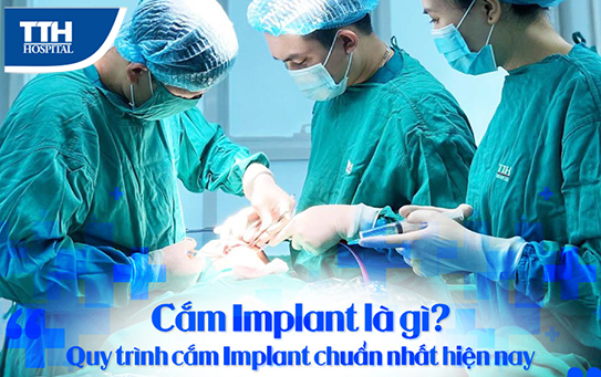 Quy trình cắm trụ implant chuẩn