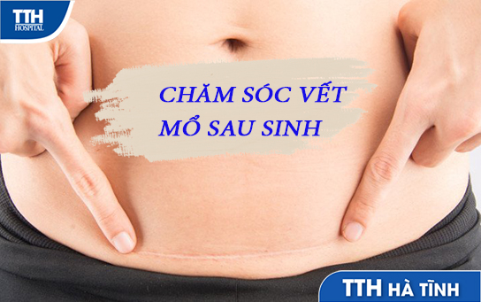 Chăm sóc vết mổ sau sinh