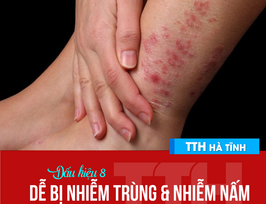 09 DẤU HIỆU DỄ DÀNG NHẬN BIẾT KHI BỊ ĐÁI THÁO ĐƯỜNG