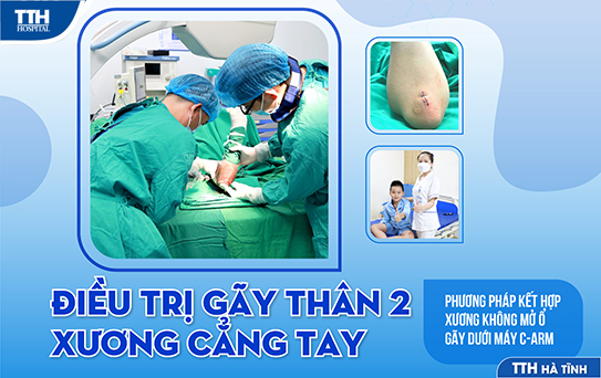 phương pháp mới điều trị gãy xương ở trẻ em.