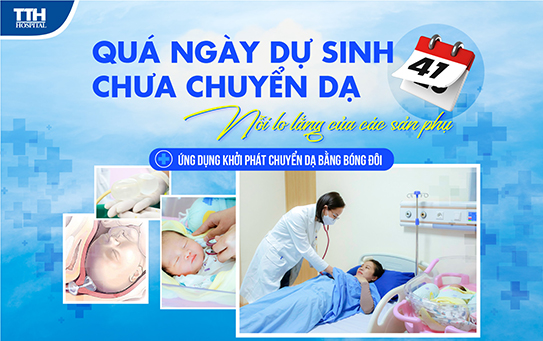 Khởi phát chuyển dạ