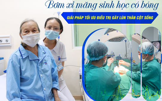 BƠM XI MĂNG SINH HỌC  – GIẢI PHÁP TỐI ƯU ĐIỀU TRỊ VỠ LÚN THÂN CỘT SỐNG