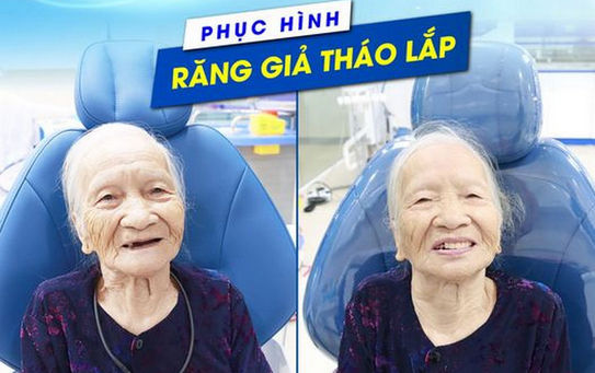 PHỤC HÌNH RĂNG GIẢ THÁO LẮP