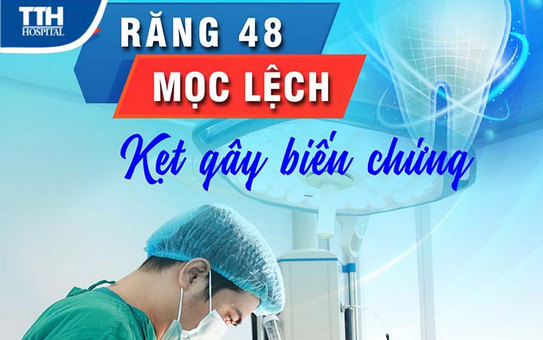 PHẪU THUẬT RĂNG 48 MỌC LỆCH KẸT GÂY BIẾN CHỨNG