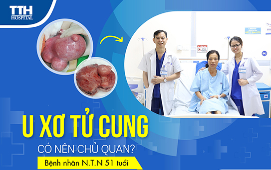 U xơ tử cung, có nên chủ quan