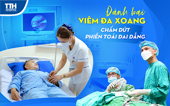 Viêm đa xoang và những điều cần biết