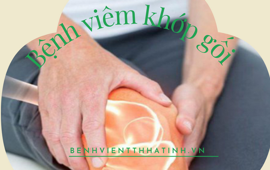 Viêm khớp gối - nguyên nhân, triệu chứng và cách điều trị