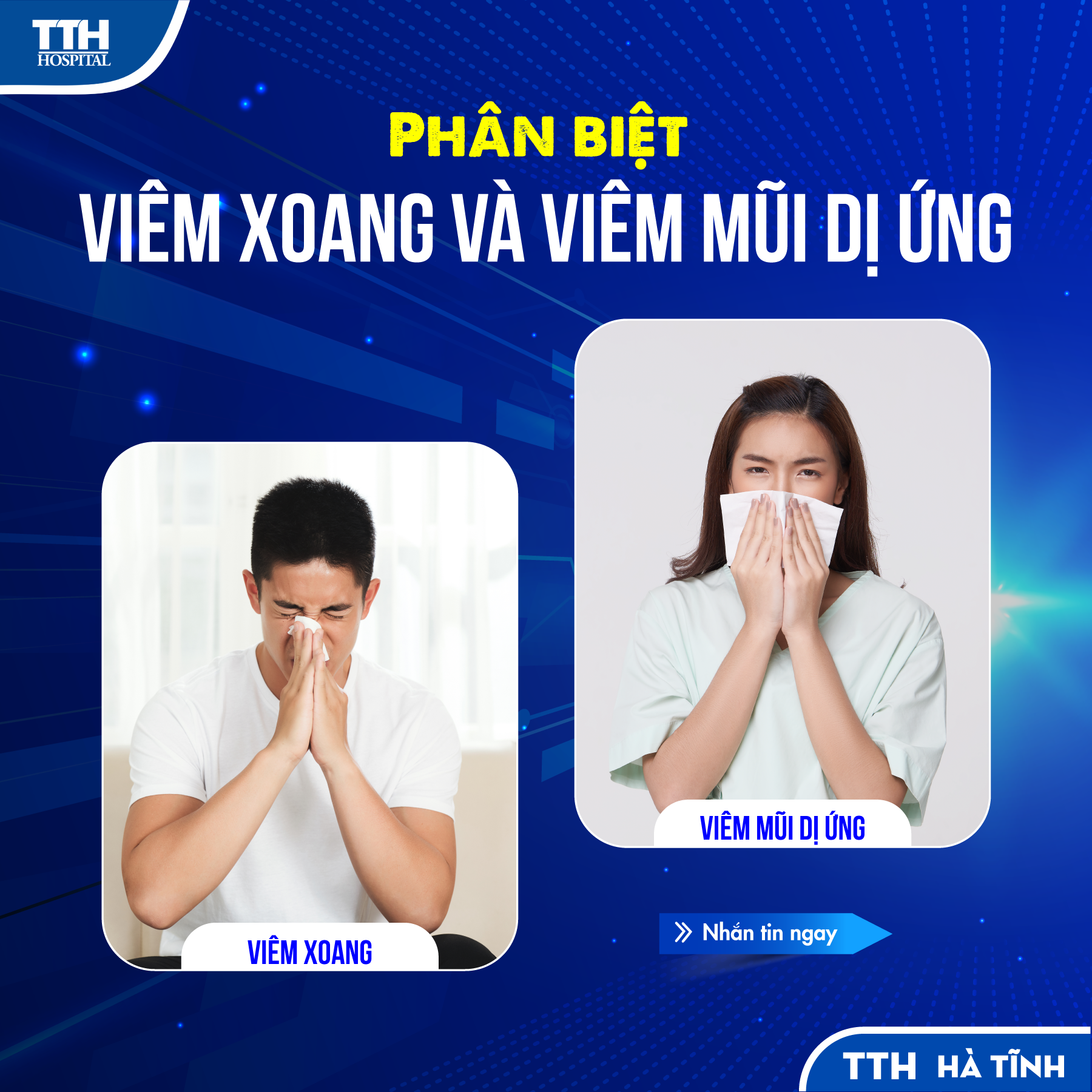 PHÂN BIỆT VIÊM XOANG VÀ VIÊM MŨI DỊ ỨNG